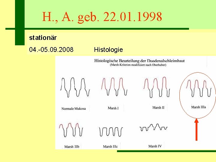 H. , A. geb. 22. 01. 1998 stationär 04. -05. 09. 2008 Histologie 