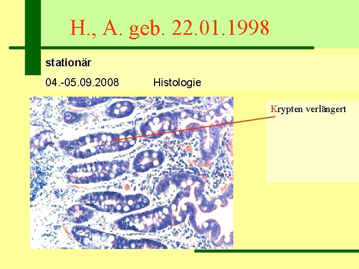 H. , A. geb. 22. 01. 1998 stationär 04. -05. 09. 2008 Histologie Krypten