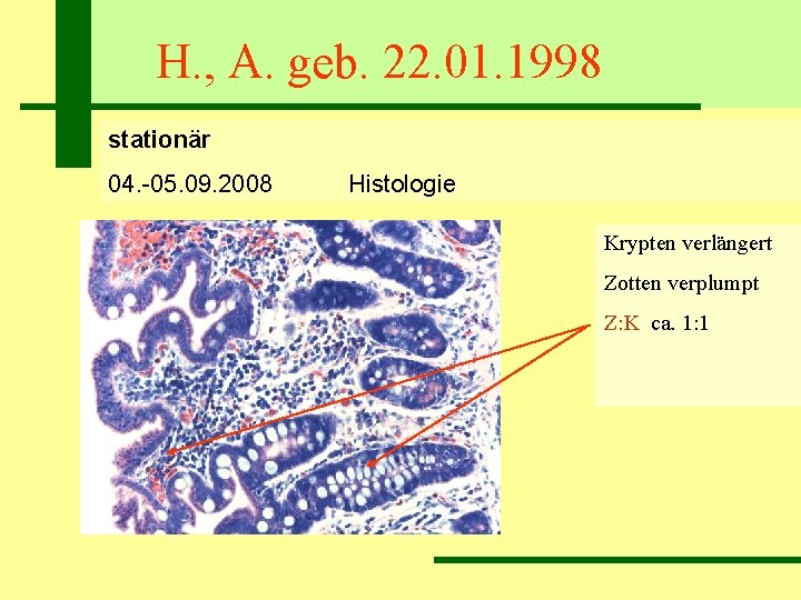 H. , A. geb. 22. 01. 1998 stationär 04. -05. 09. 2008 Histologie Krypten