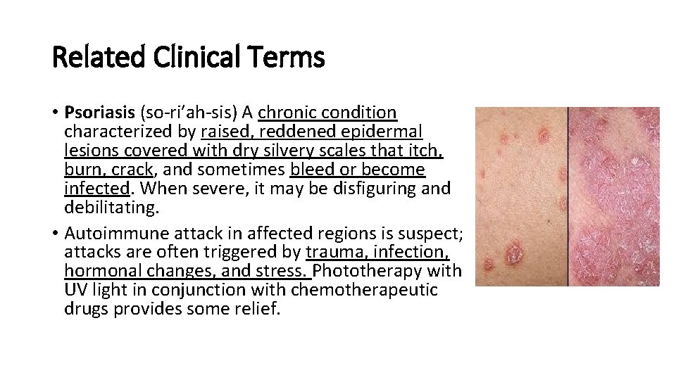 Related Clinical Terms • Psoriasis (so-ri′ah-sis) A chronic condition characterized by raised, reddened epidermal