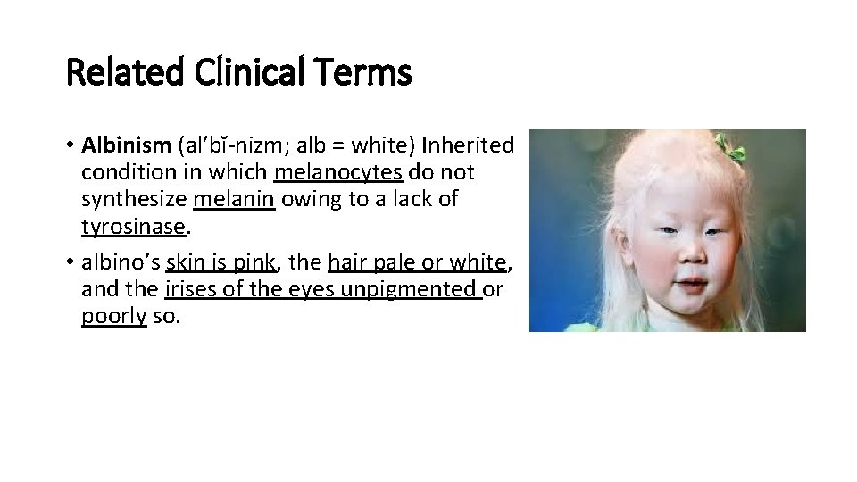 Related Clinical Terms • Albinism (al′bĭ-nizm; alb = white) Inherited condition in which melanocytes