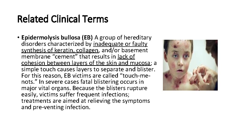 Related Clinical Terms • Epidermolysis bullosa (EB) A group of hereditary disorders characterized by