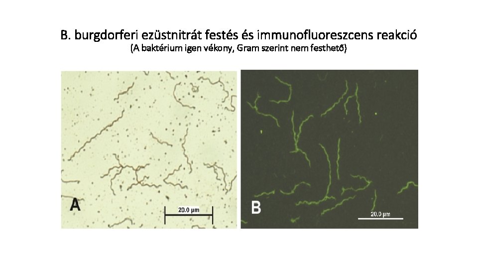 B. burgdorferi ezüstnitrát festés és immunofluoreszcens reakció (A baktérium igen vékony, Gram szerint nem