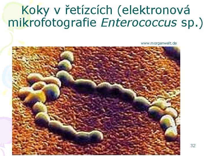Koky v řetízcích (elektronová mikrofotografie Enterococcus sp. ) www. morgenwelt. de 32 