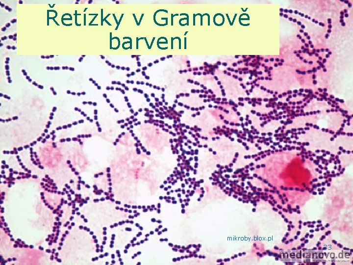 Řetízky v Gramově barvení mikroby. blox. pl 33 