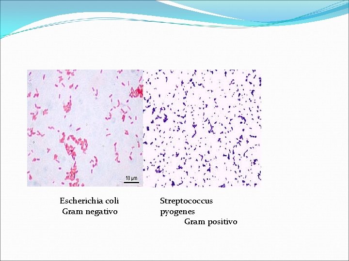 Escherichia coli Gram negativo Streptococcus pyogenes Gram positivo 