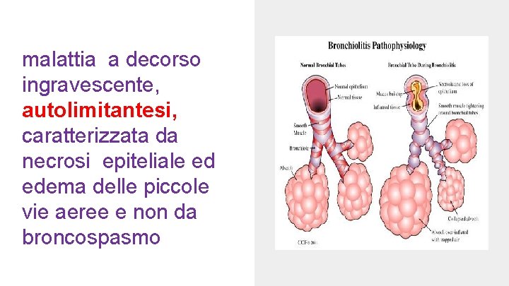 malattia a decorso ingravescente, autolimitantesi, caratterizzata da necrosi epiteliale ed edema delle piccole vie