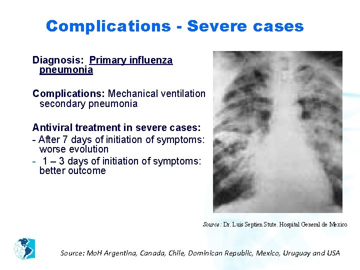 Complications - Severe cases Diagnosis: Primary influenza pneumonia Complications: Mechanical ventilation secondary pneumonia Antiviral