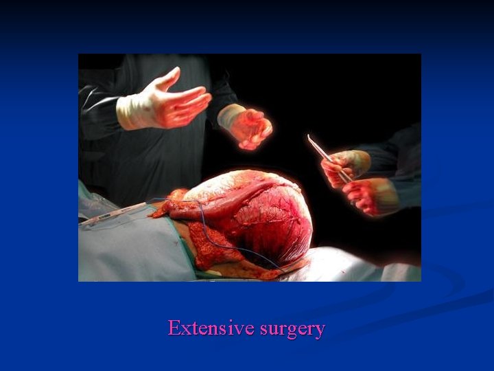 Extensive surgery 