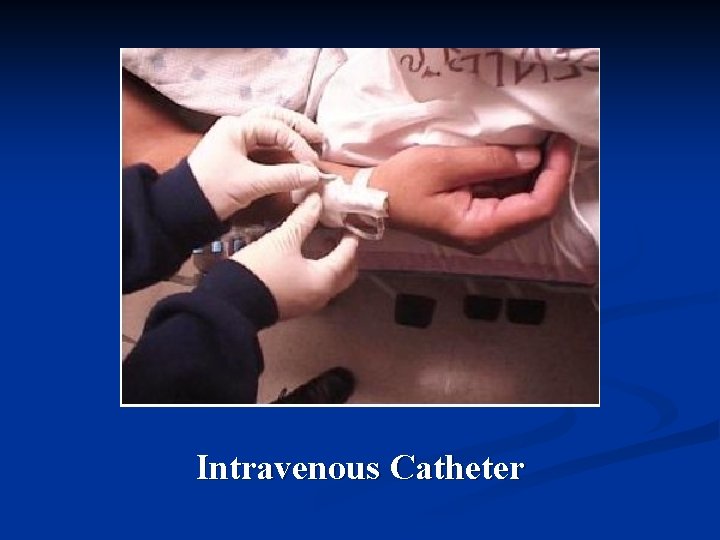 Intravenous Catheter 