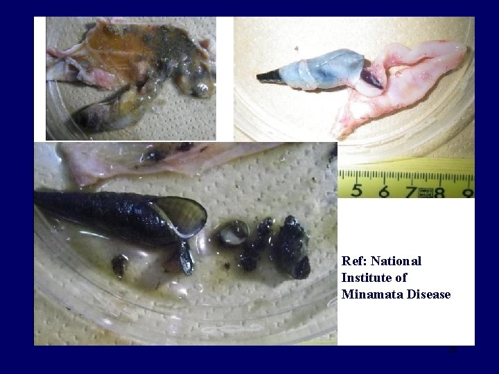 Ref: National Institute of Minamata Disease 26 