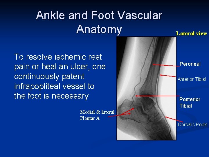 Ankle and Foot Vascular Anatomy To resolve ischemic rest pain or heal an ulcer,