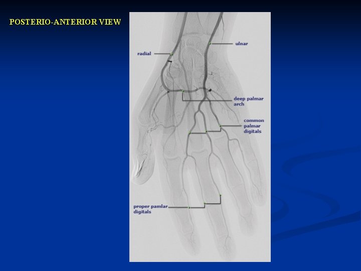 POSTERIO-ANTERIOR VIEW 