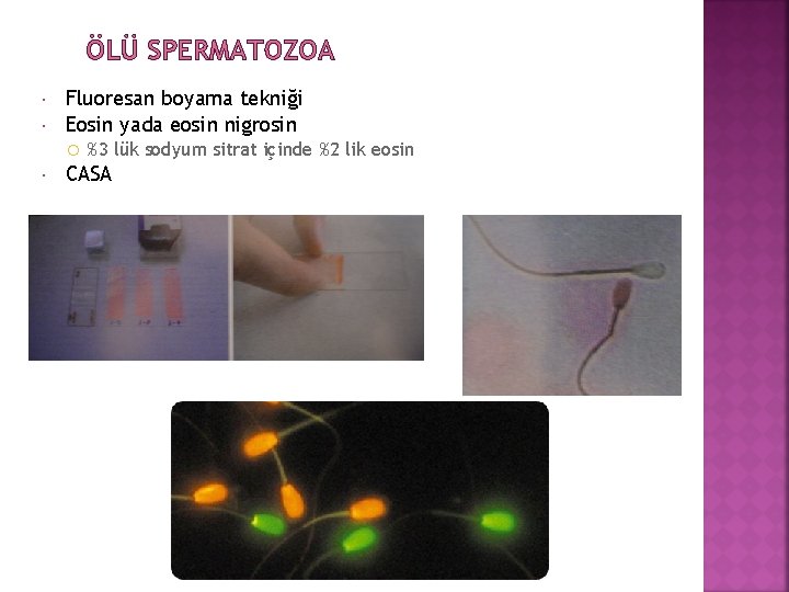 ÖLÜ SPERMATOZOA Fluoresan boyama tekniği Eosin yada eosin nigrosin %3 lük sodyum sitrat içinde