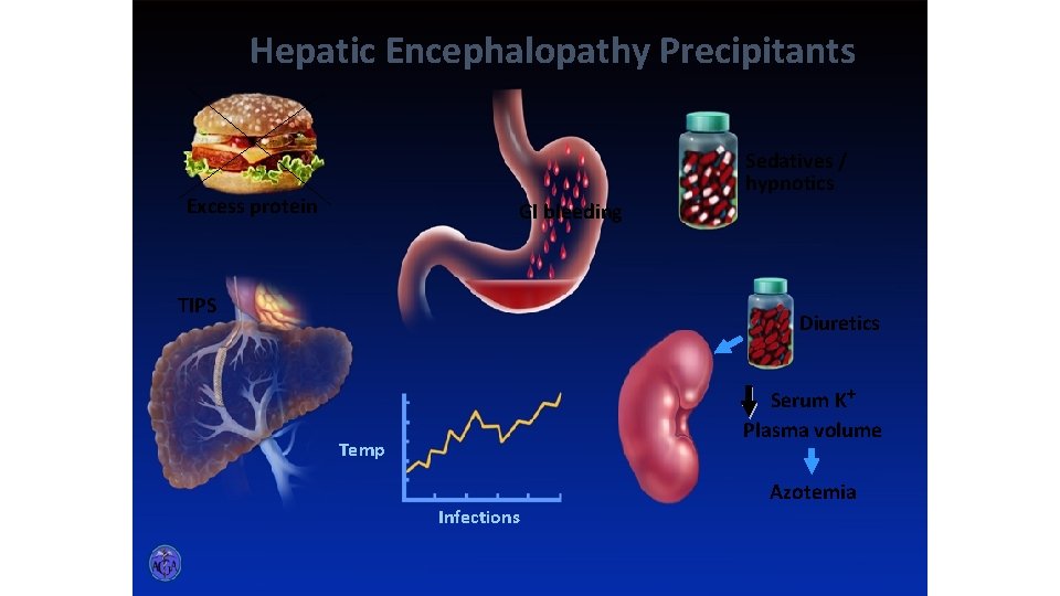 Hepatic Encephalopathy Precipitants Sedatives / hypnotics Excess protein GI bleeding TIPS Diuretics Serum K+