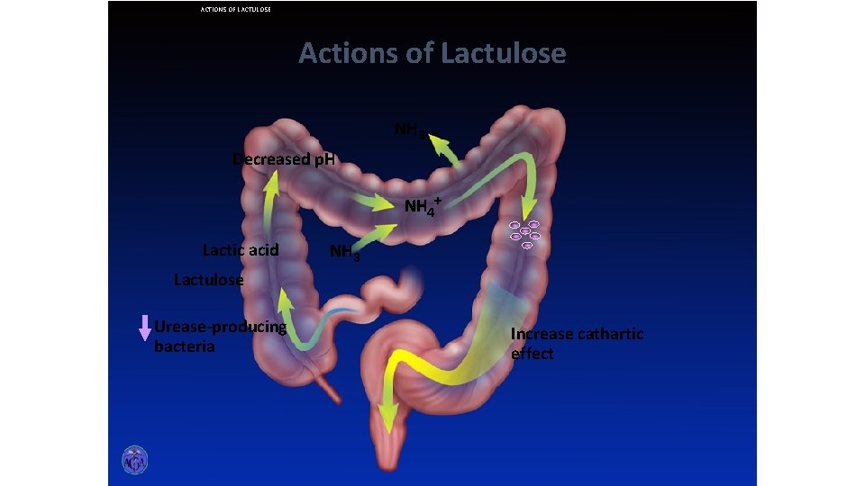 ACTIONS OF LACTULOSE Actions of Lactulose NH 3 Decreased p. H NH 4+ Lactic