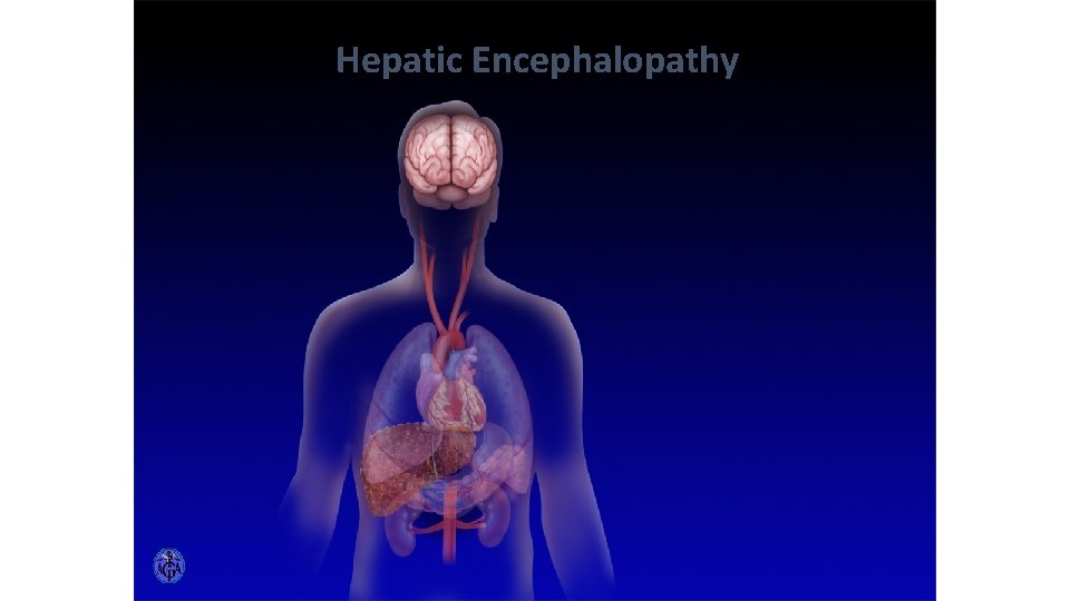 HEPATIC ENCEPHALOPATHY Hepatic Encephalopathy 