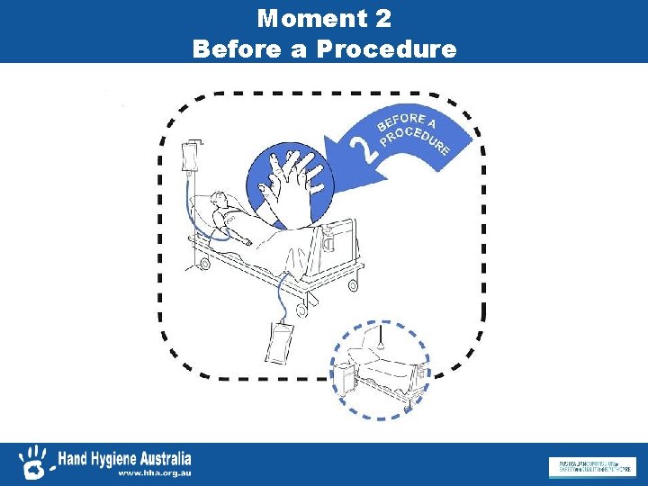 Moment 2 Before a Procedure 