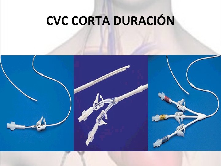 CVC CORTA DURACIÓN 
