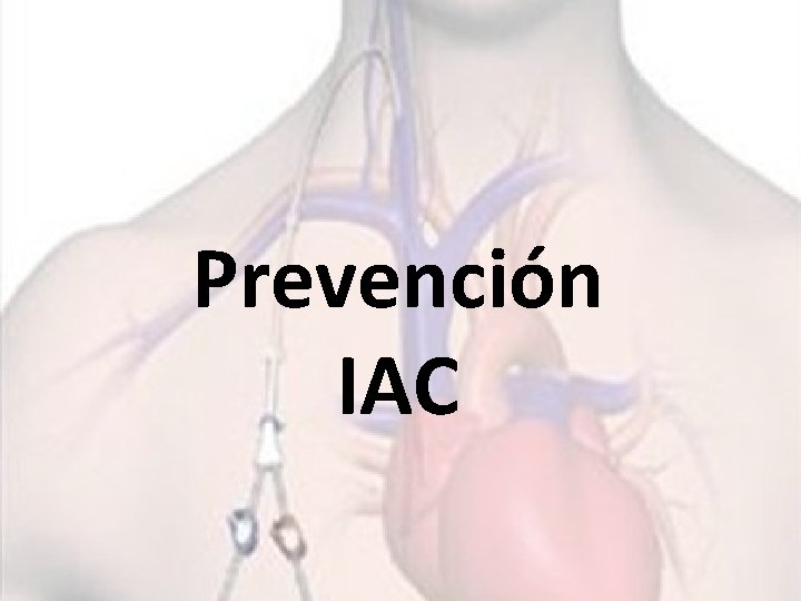 Prevención IAC 