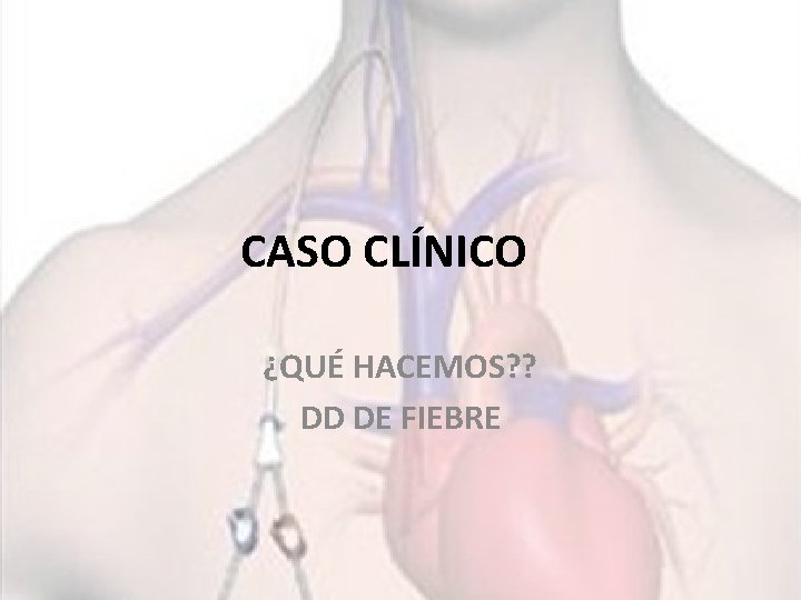CASO CLÍNICO ¿QUÉ HACEMOS? ? DD DE FIEBRE 