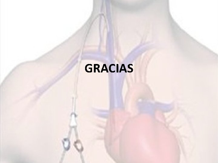 GRACIAS 