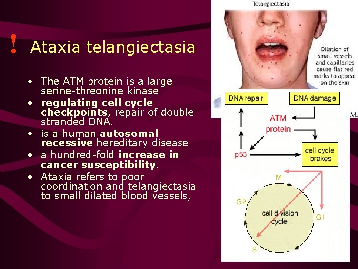 ! Ataxia telangiectasia • The ATM protein is a large serine-threonine kinase • regulating