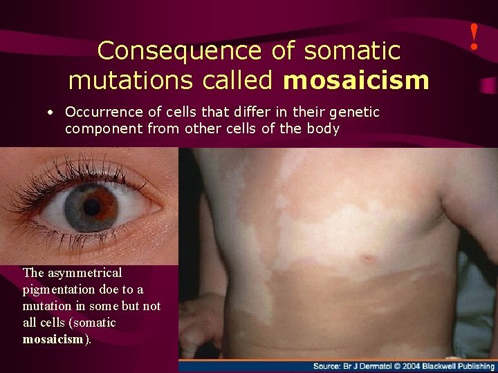 ! Consequence of somatic mutations called mosaicism • Occurrence of cells that differ in