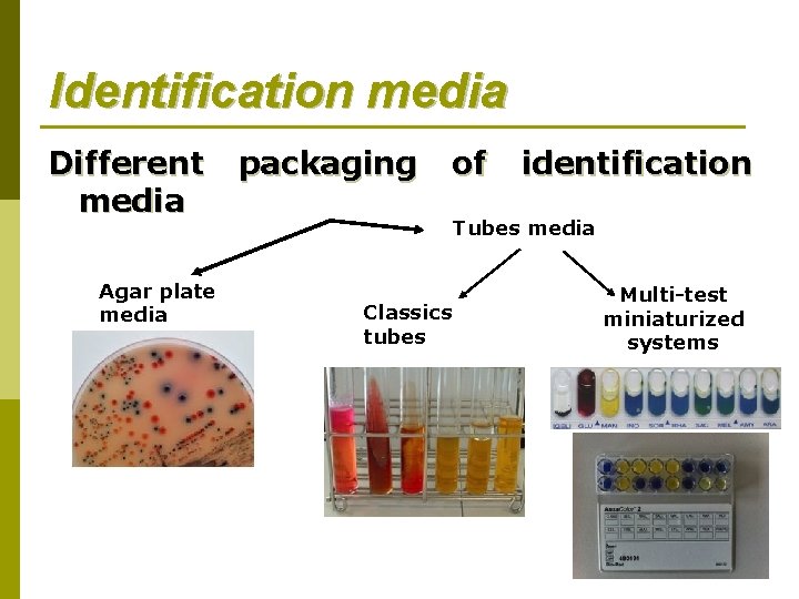 Identification media Different packaging of identification media Tubes media Agar plate media Classics tubes Identification media Different packaging of identification media Tubes media Agar plate media Classics tubes