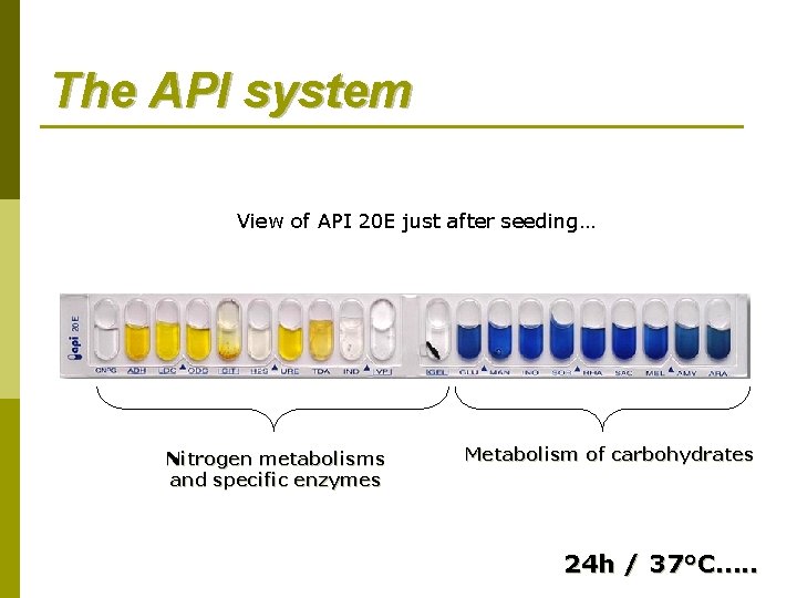 The API system View of API 20 E just after seeding… Nitrogen metabolisms and The API system View of API 20 E just after seeding… Nitrogen metabolisms and