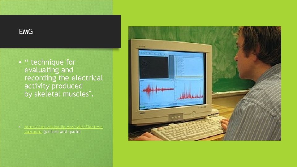 EMG • “ technique for evaluating and recording the electrical activity produced by skeletal