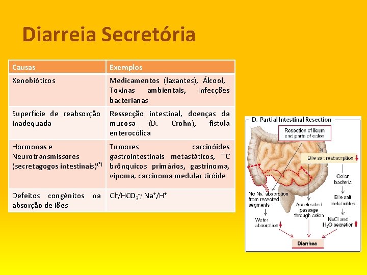 Diarreia Secretória Causas Exemplos Xenobióticos Medicamentos (laxantes), Álcool, Toxinas ambientais, Infecções bacterianas Superfície de