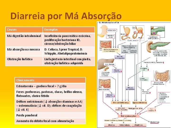 Diarreia por Má Absorção Causas Exemplos Má digestão intraluminal Insuficiência pancreática exócrina, proliferação bacteriana