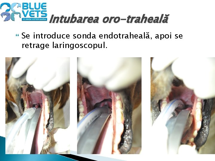 Intubarea oro-traheală Se introduce sonda endotraheală, apoi se retrage laringoscopul. 