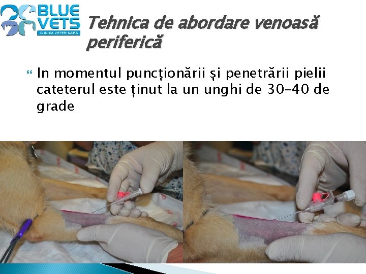 Tehnica de abordare venoasă periferică In momentul puncționării și penetrării pielii cateterul este ținut