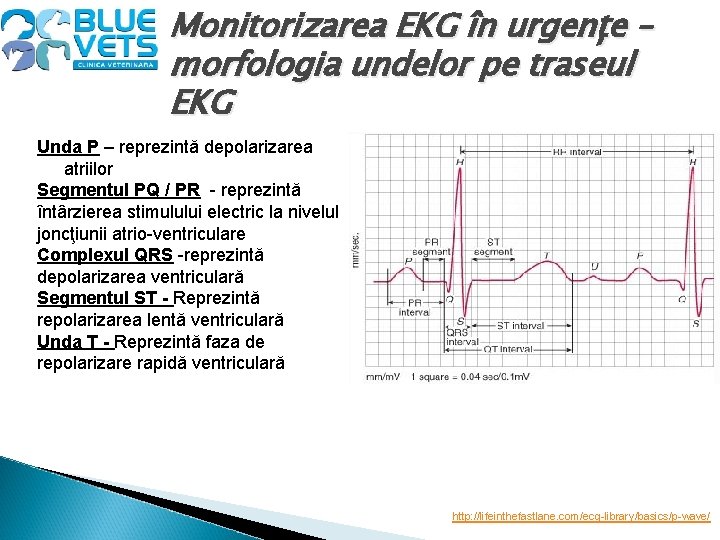 Monitorizarea EKG în urgențe – morfologia undelor pe traseul EKG Unda P – reprezintă