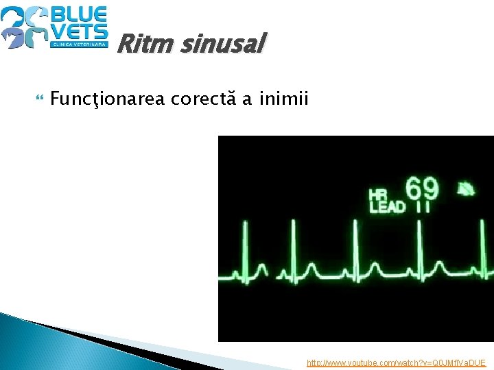 Ritm sinusal Funcţionarea corectă a inimii http: //www. youtube. com/watch? v=Q 0 JMf. IVa.