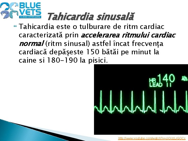  Tahicardia sinusală Tahicardia este o tulburare de ritm cardiac caracterizată prin accelerarea ritmului
