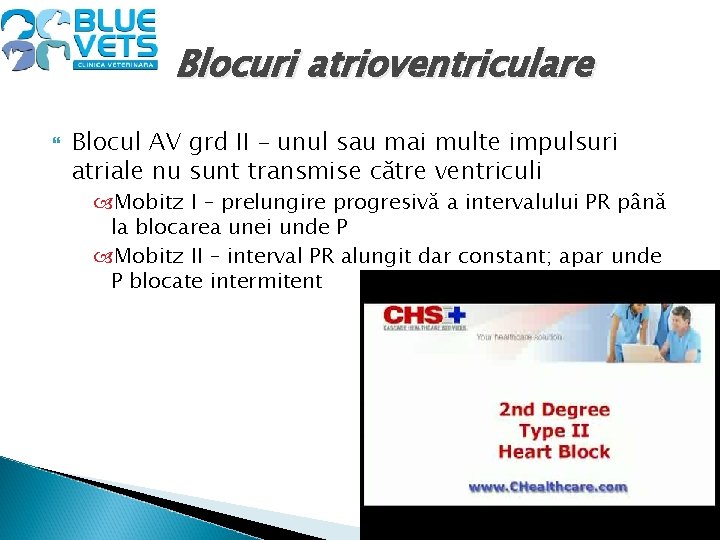 Blocuri atrioventriculare Blocul AV grd II – unul sau mai multe impulsuri atriale nu