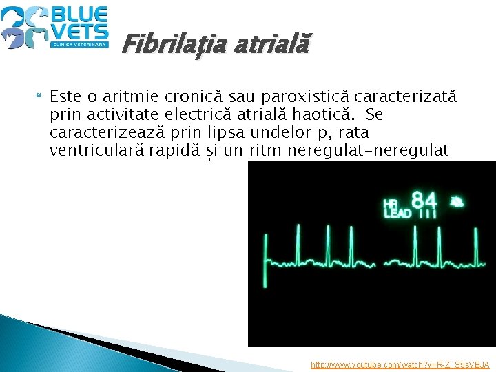 Fibrilația atrială Este o aritmie cronică sau paroxistică caracterizată prin activitate electrică atrială haotică.