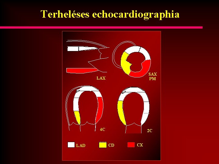 Terheléses echocardiographia SAX PM LAX 4 C LAD 2 C CD CX 
