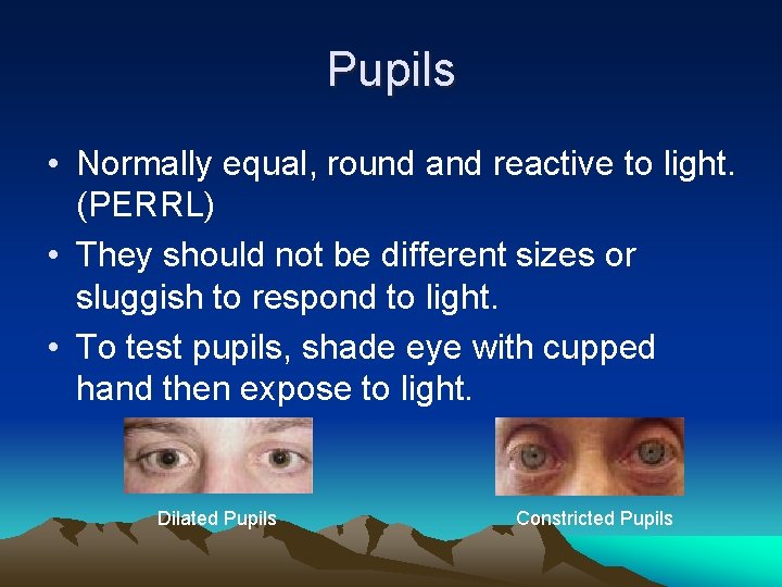 Pupils • Normally equal, round and reactive to light. (PERRL) • They should not