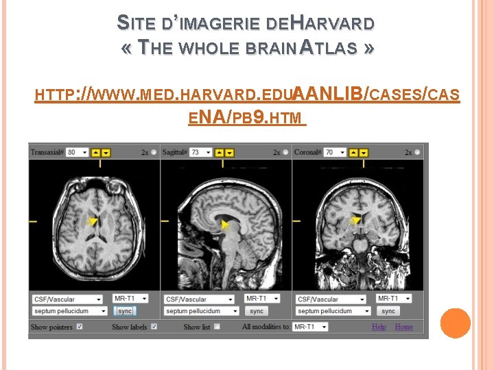 SITE D’IMAGERIE DE HARVARD « THE WHOLE BRAIN ATLAS » HTTP: //WWW. MED. HARVARD.
