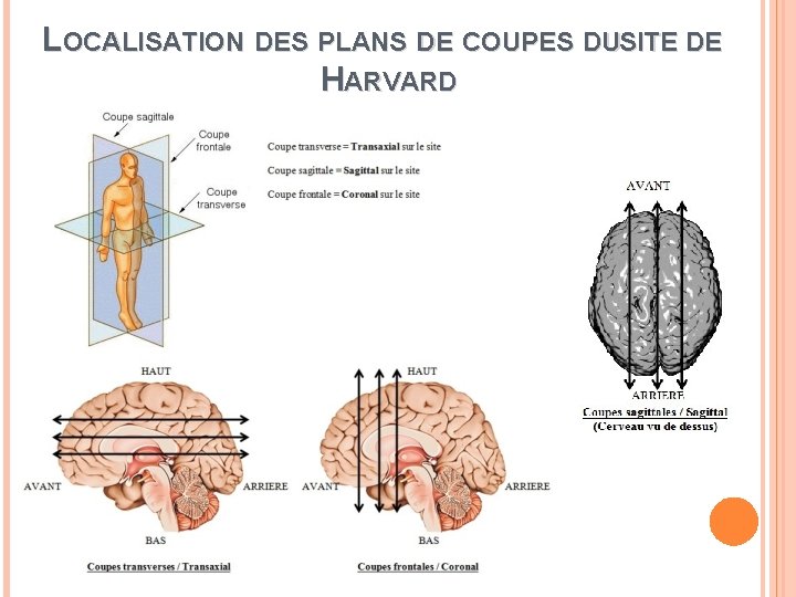 LOCALISATION DES PLANS DE COUPES DUSITE DE S HARVARD 