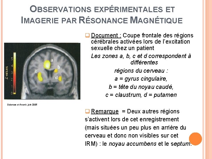 OBSERVATIONS EXPÉRIMENTALES ET IMAGERIE PAR RÉSONANCE MAGNÉTIQUE ② Sciences et Avenir, juin 2005 ➂