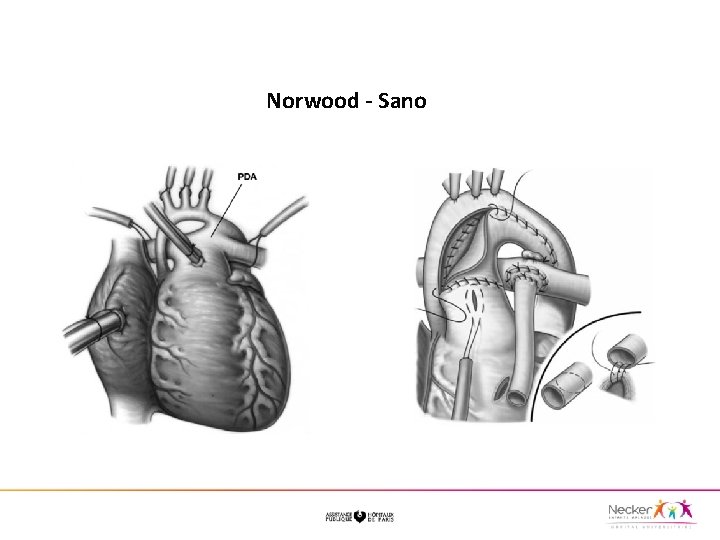  Norwood - Sano 
