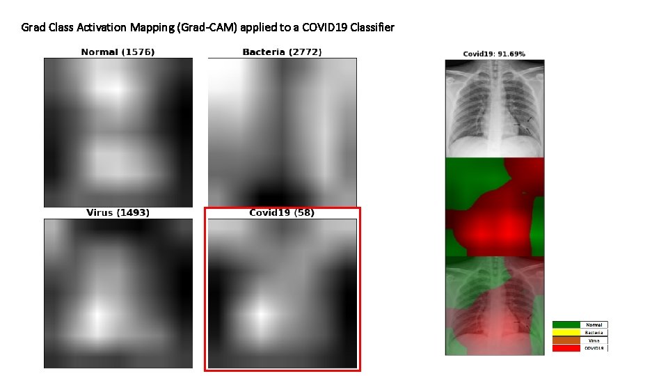 Grad Class Activation Mapping (Grad-CAM) applied to a COVID 19 Classifier 