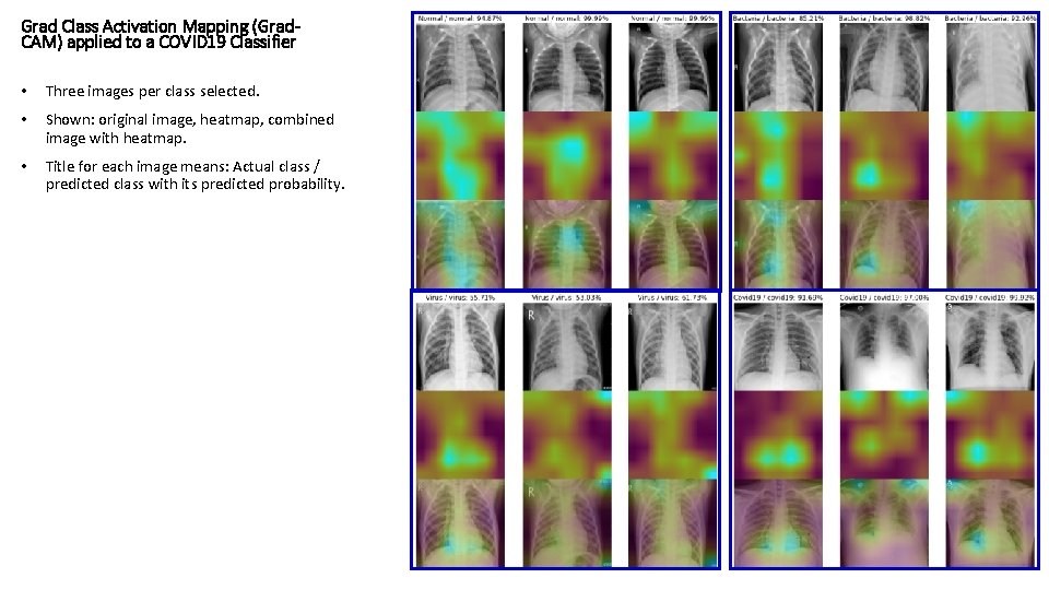 Grad Class Activation Mapping (Grad. CAM) applied to a COVID 19 Classifier • Three