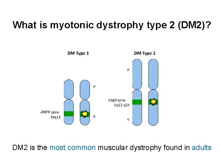 What is myotonic dystrophy type 2 (DM 2)? DM 2 is the most common