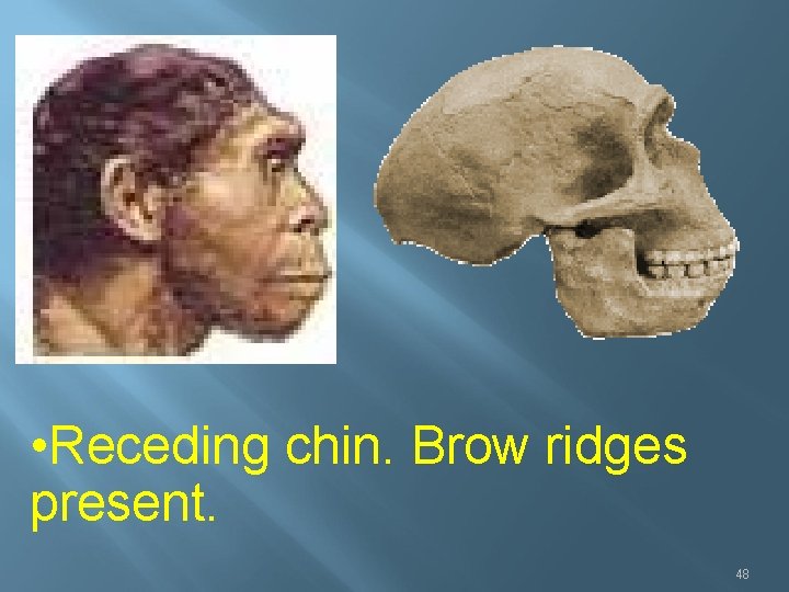  • Receding chin. Brow ridges present. 48 